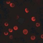 CASKIN2 Antibody in Immunocytochemistry (ICC/IF)