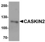 CASKIN2 Antibody in Western Blot (WB)