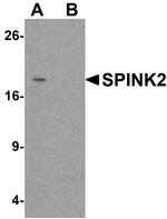 SPINK2 Antibody in Western Blot (WB)