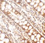 PPHLN1 Antibody in Immunohistochemistry (Paraffin) (IHC (P))