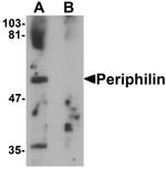 PPHLN1 Antibody in Western Blot (WB)