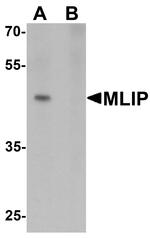 MLIP Antibody in Western Blot (WB)