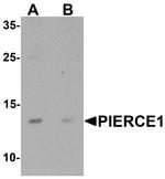 C9orf116 Antibody in Western Blot (WB)