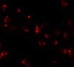 Nkx2.4 Antibody in Immunocytochemistry (ICC/IF)
