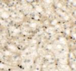 Nkx2.6 Polyclonal Antibody
