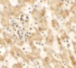 Nkx2.8 Polyclonal Antibody