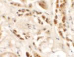 SIGLEC15 Polyclonal Antibody