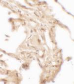 WFDC2 Polyclonal Antibody