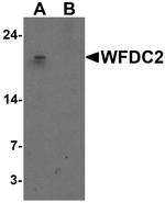 WFDC2 Antibody in Western Blot (WB)