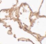 Arylsulfatase B Polyclonal Antibody