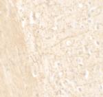 ARTS1 Polyclonal Antibody