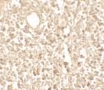 TMEM107 Polyclonal Antibody