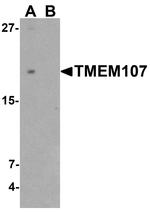TMEM107 Antibody in Western Blot (WB)