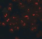 PHF14 Polyclonal Antibody