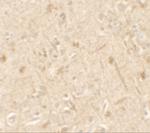 IL1F6 Polyclonal Antibody