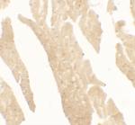 IL1F5 Polyclonal Antibody