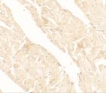 JTV-1 Polyclonal Antibody