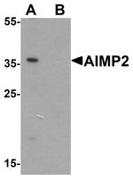JTV-1 Antibody in Western Blot (WB)