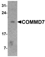 COMMD7 Antibody in Western Blot (WB)