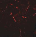 PAT1 Antibody in Immunohistochemistry (Paraffin) (IHC (P))
