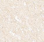 PAT1 Polyclonal Antibody