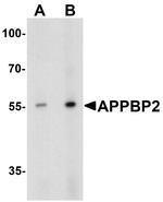 PAT1 Antibody in Western Blot (WB)