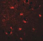 MAP1LC3C Antibody in Immunohistochemistry (Paraffin) (IHC (P))