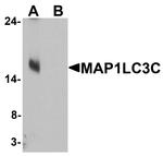 MAP1LC3C Antibody in Western Blot (WB)