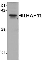 THAP11 Polyclonal Antibody