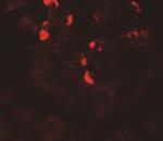 GLIPR1L1 Antibody in Immunohistochemistry (Paraffin) (IHC (P))