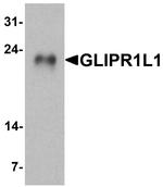 GLIPR1L1 Antibody in Western Blot (WB)