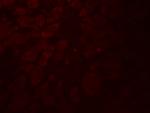 GLIPR1L2 Antibody in Immunohistochemistry (Paraffin) (IHC (P))
