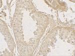 GLIPR1L2 Polyclonal Antibody