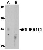 GLIPR1L2 Antibody in Western Blot (WB)