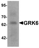 GRK6 Antibody in Western Blot (WB)