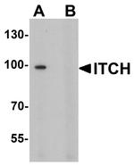 ITCH Polyclonal Antibody