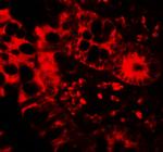 APOBEC3B Antibody in Immunohistochemistry (Paraffin) (IHC (P))