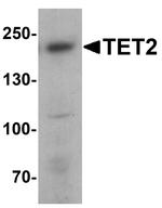 TET2 Polyclonal Antibody