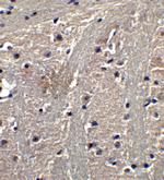 TET1 Polyclonal Antibody