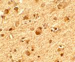 TET1 Antibody in Immunohistochemistry (Paraffin) (IHC (P))