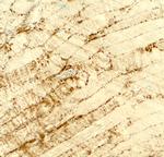 DCANP1 Antibody in Immunohistochemistry (Paraffin) (IHC (P))