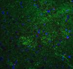 MFN2 Polyclonal Antibody