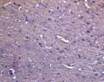 MFN2 Antibody in Immunohistochemistry (Paraffin) (IHC (P))