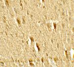 MFN2 Antibody in Immunohistochemistry (Paraffin) (IHC (P))