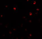 NDST2 Polyclonal Antibody