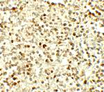 NOX4 Polyclonal Antibody