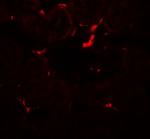 Vezatin Polyclonal Antibody