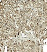 KIRREL2 Polyclonal Antibody