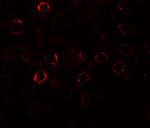 KIRREL3 Antibody in Immunohistochemistry (Paraffin) (IHC (P))