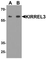 KIRREL3 Antibody in Western Blot (WB)
